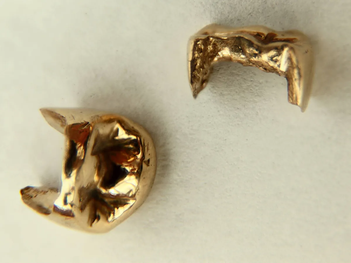 Gouden tandheelkundige inlays en reststukken